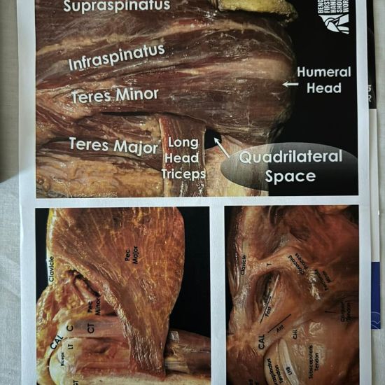 Workshop on Shoulder Anatomy and Surgery