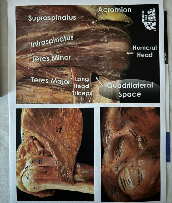 Workshop on Shoulder Anatomy and Surgery